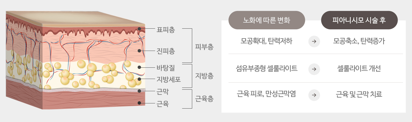 얼굴 조직의 변화