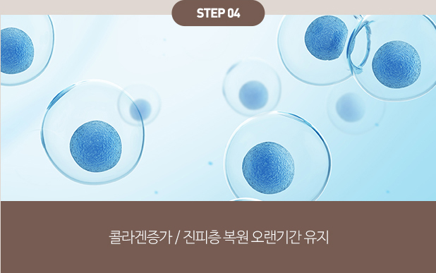 섬유아세포치료 