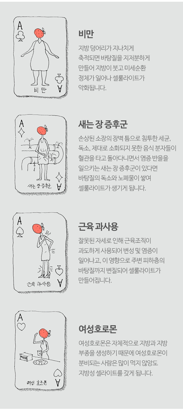 비만·셀룰라이트