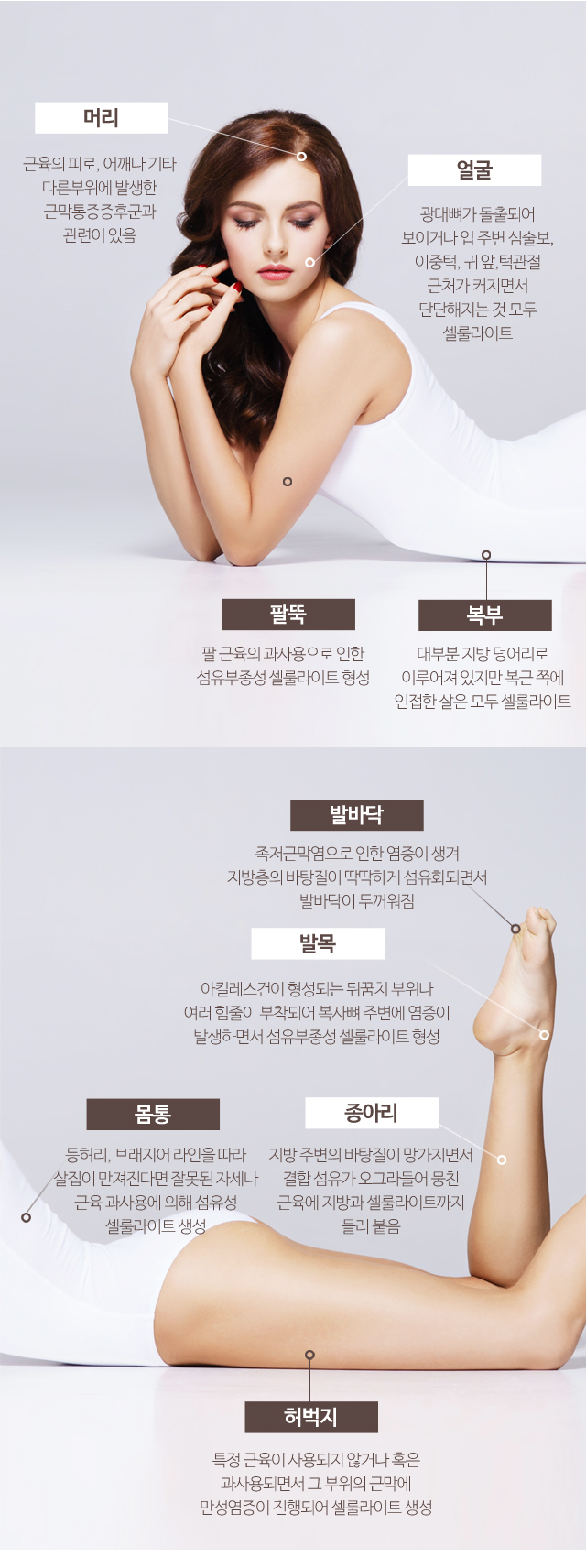 비만·셀룰라이트