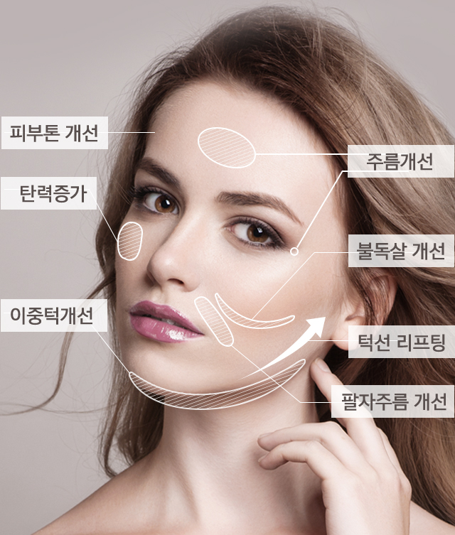 피아니시모 시술 효과