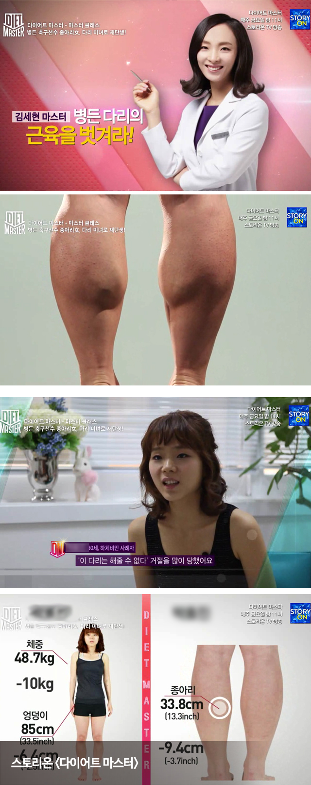 방송에 소개된 스키니필